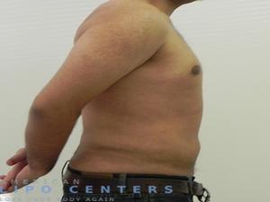 americanlipocenters_121.jpg